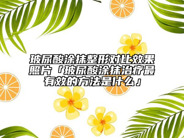 玻尿酸涂抹整形对比效果照片「玻尿酸涂抹治疗最有效的方法是什么」