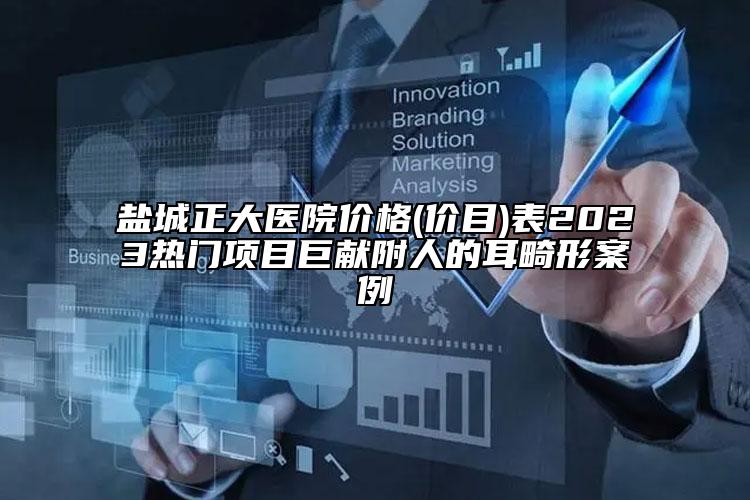 盐城正大医院价格(价目)表2023热门项目巨献附人的耳畸形案例