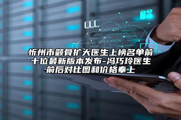 忻州市颧骨扩大医生上榜名单前十位最新版本发布-冯巧玲医生前后对比图和价格奉上