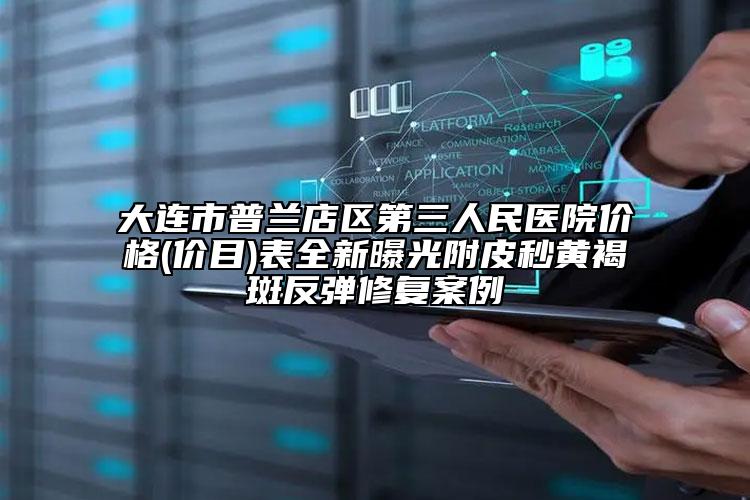 大连市普兰店区第三人民医院价格(价目)表全新曝光附皮秒黄褐斑反弹修复案例