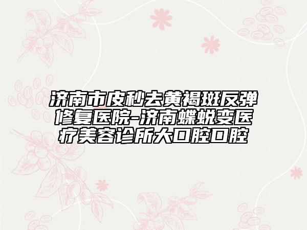济南市皮秒去黄褐斑反弹修复医院-济南蝶蜕变医疗美容诊所大口腔口腔
