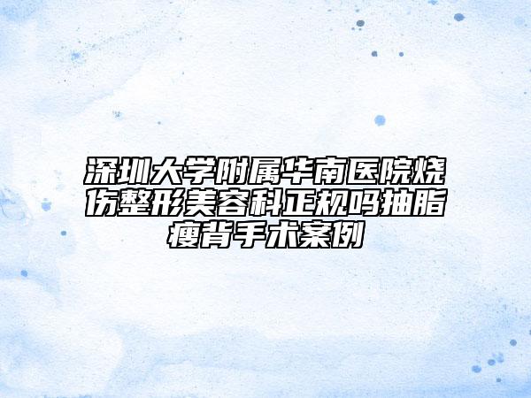 深圳大学附属华南医院烧伤整形美容科正规吗抽脂瘦背手术案例