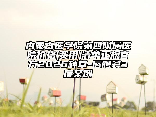 内蒙古医学院第四附属医院价格(费用)清单正规官方2026种草-唇腭裂3度案例