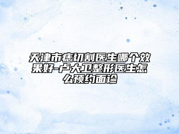 天津市痣切割医生哪个效果好-卢大卫整形医生怎么预约面诊