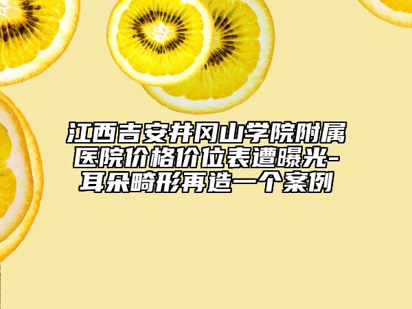 江西吉安井冈山学院附属医院价格价位表遭曝光-耳朵畸形再造一个案例