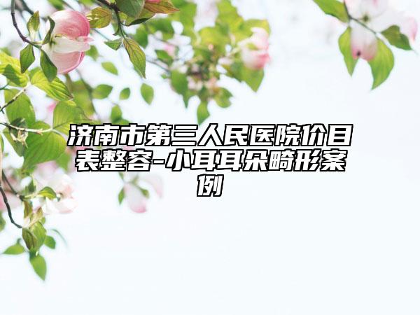 济南市第三人民医院价目表整容-小耳耳朵畸形案例