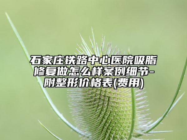 石家庄铁路中心医院吸脂修复做怎么样案例细节-附整形价格表(费用)