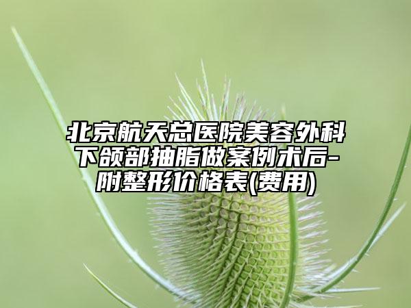 北京航天总医院美容外科下颌部抽脂做案例术后-附整形价格表(费用)