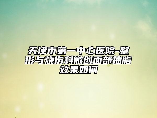 天津市第一中心医院-整形与烧伤科微创面部抽脂效果如何