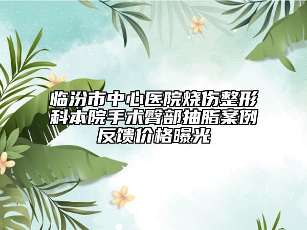 临汾市中心医院烧伤整形科本院手术臀部抽脂案例反馈价格曝光