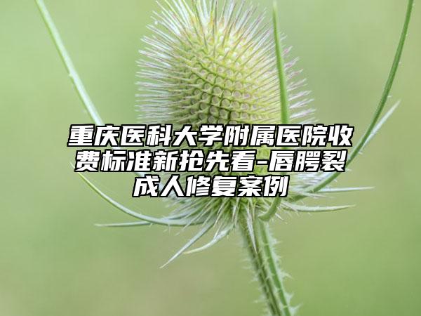 重庆医科大学附属医院收费标准新抢先看-唇腭裂成人修复案例