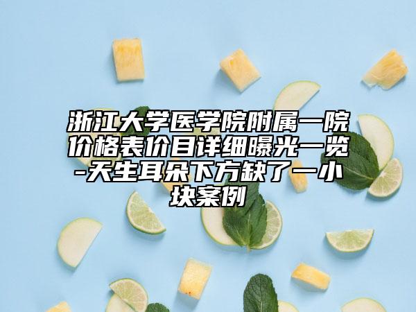 浙江大学医学院附属一院价格表价目详细曝光一览-天生耳朵下方缺了一小块案例