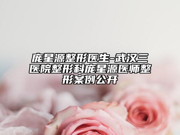庞星源整形医生-武汉三医院整形科庞星源医师整形案例公开
