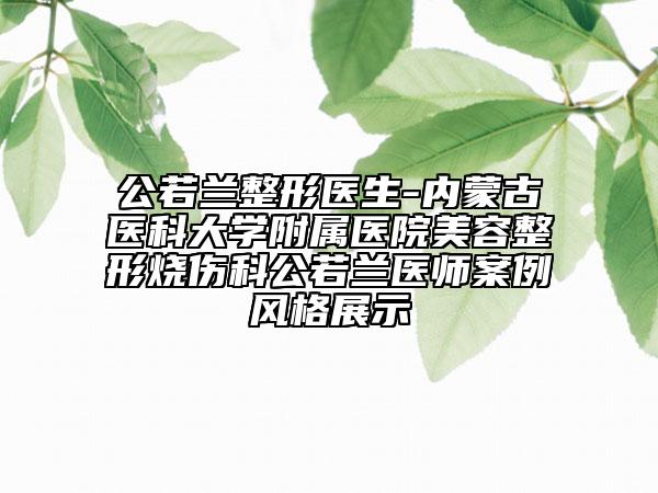 公若兰整形医生-内蒙古医科大学附属医院美容整形烧伤科公若兰医师案例风格展示