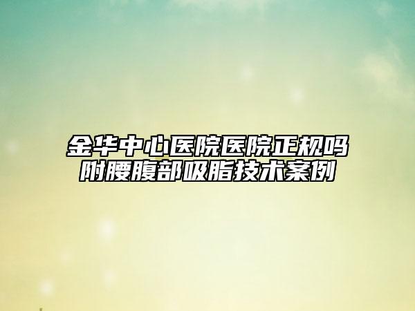 金华中心医院医院正规吗附腰腹部吸脂技术案例