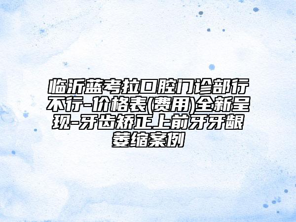 临沂蓝考拉口腔门诊部行不行-价格表(费用)全新呈现-牙齿矫正上前牙牙龈萎缩案例