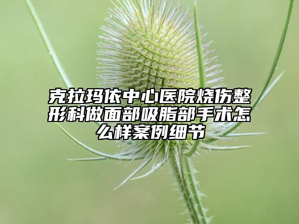 克拉玛依中心医院烧伤整形科做面部吸脂部手术怎么样案例细节