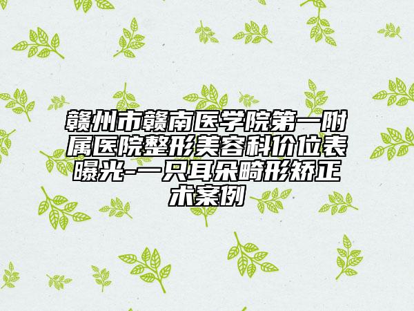 赣州市赣南医学院第一附属医院整形美容科价位表曝光-一只耳朵畸形矫正术案例
