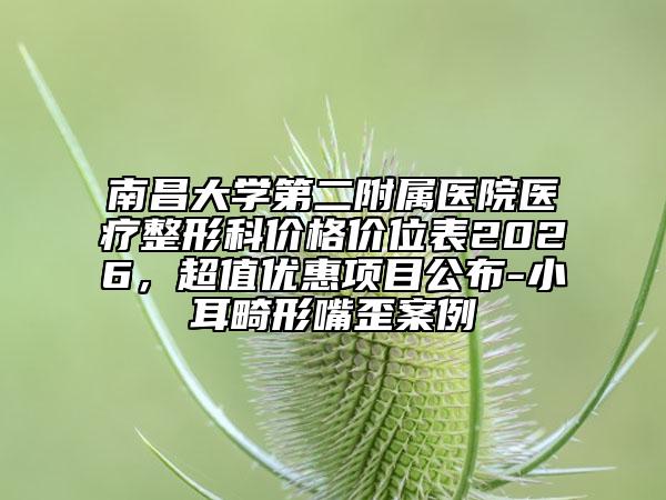南昌大学第二附属医院医疗整形科价格价位表2026，超值优惠项目公布-小耳畸形嘴歪案例