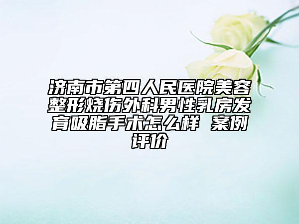 济南市第四人民医院美容整形烧伤外科男性乳房发育吸脂手术怎么样 案例评价
