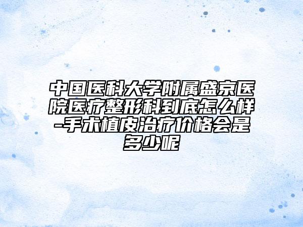中国医科大学附属盛京医院医疗整形科到底怎么样-手术植皮治疗价格会是多少呢