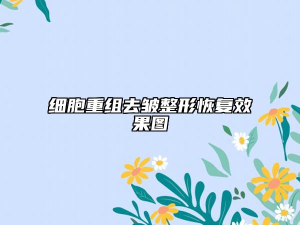 细胞重组去皱整形恢复效果图