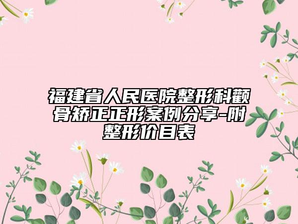 福建省人民医院整形科颧骨矫正正形案例分享-附整形价目表