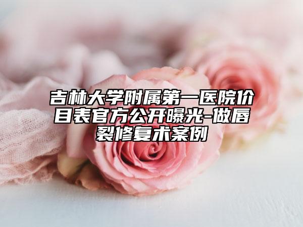 吉林大学附属第一医院价目表官方公开曝光-做唇裂修复术案例