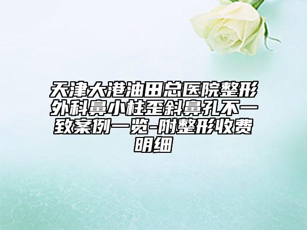 天津大港油田总医院整形外科鼻小柱歪斜鼻孔不一致案例一览-附整形收费明细