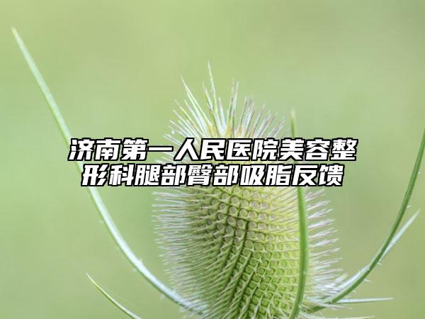 济南第一人民医院美容整形科腿部臀部吸脂反馈
