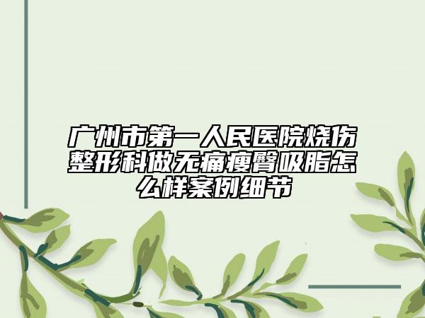 广州市第一人民医院烧伤整形科做无痛瘦臀吸脂怎么样案例细节