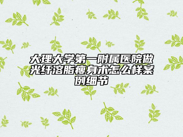 大理大学第一附属医院做光纤溶脂瘦身术怎么样案例细节