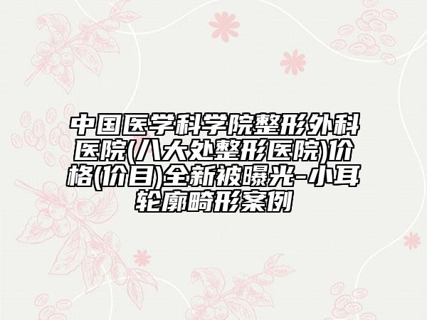 中国医学科学院整形外科医院(八大处整形医院)价格(价目)全新被曝光-小耳轮廓畸形案例