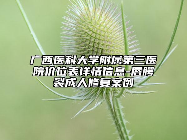 广西医科大学附属第三医院价位表详情信息-唇腭裂成人修复案例