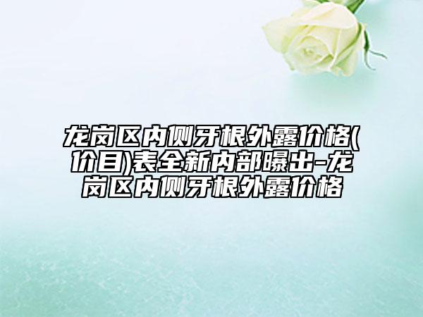 龙岗区内侧牙根外露价格(价目)表全新内部曝出-龙岗区内侧牙根外露价格