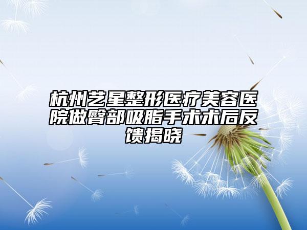 杭州艺星整形医疗美容医院做臀部吸脂手术术后反馈揭晓