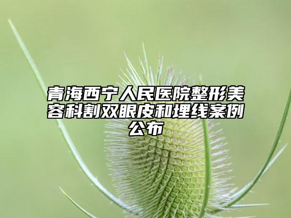 青海西宁人民医院整形美容科割双眼皮和埋线案例公布