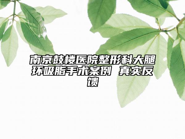 南京鼓楼医院整形科大腿环吸脂手术案例 真实反馈