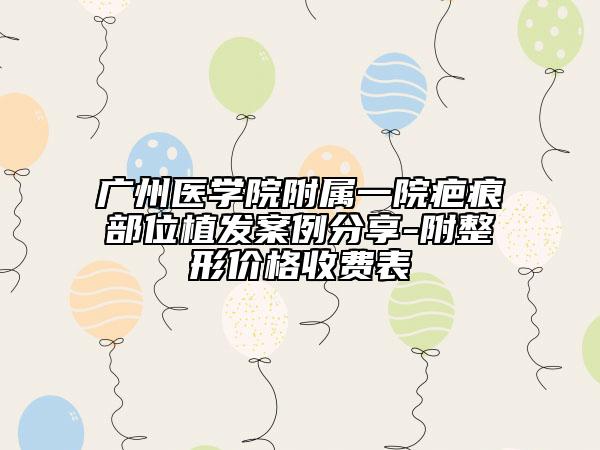 广州医学院附属一院疤痕部位植发案例分享-附整形价格收费表