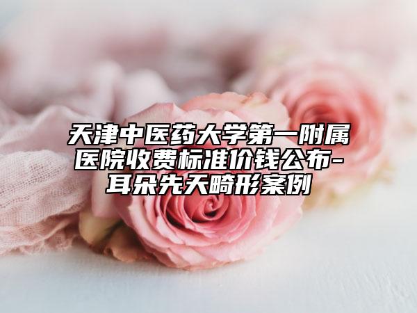 天津中医药大学第一附属医院收费标准价钱公布-耳朵先天畸形案例