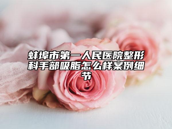 蚌埠市第一人民医院整形科手部吸脂怎么样案例细节