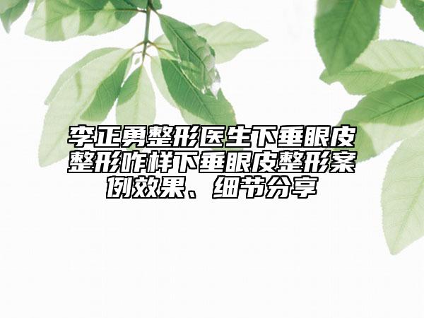 李正勇整形医生下垂眼皮整形咋样下垂眼皮整形案例效果、细节分享