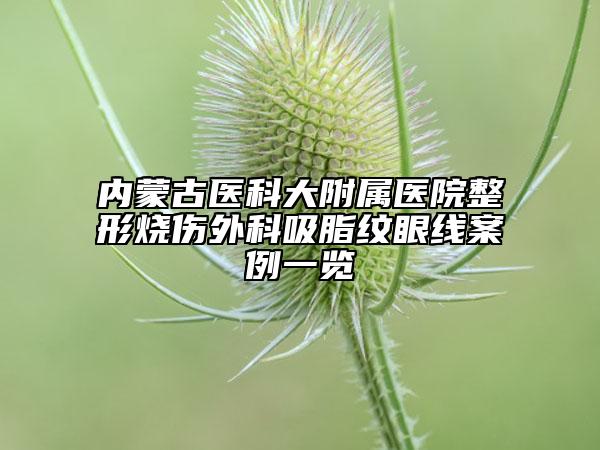 内蒙古医科大附属医院整形烧伤外科吸脂纹眼线案例一览