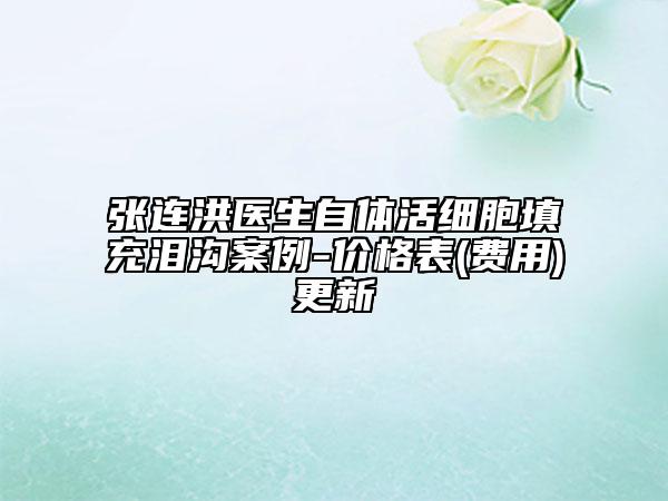 张连洪医生自体活细胞填充泪沟案例-价格表(费用)更新