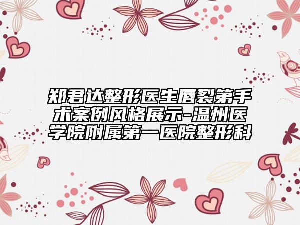 郑君达整形医生唇裂第手术案例风格展示-温州医学院附属第一医院整形科