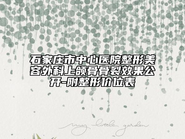 石家庄市中心医院整形美容外科上颌骨骨裂效果公开-附整形价位表