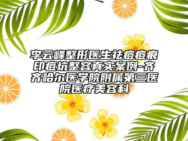李云峰整形医生祛痘痘痕印痘坑整容真实案例-齐齐哈尔医学院附属第三医院医疗美容科