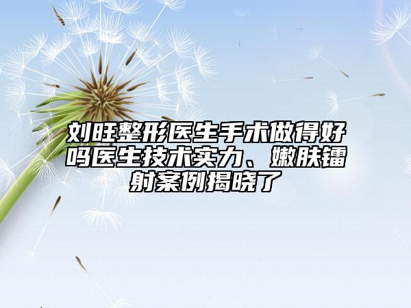 刘旺整形医生手术做得好吗医生技术实力、嫩肤镭射案例揭晓了