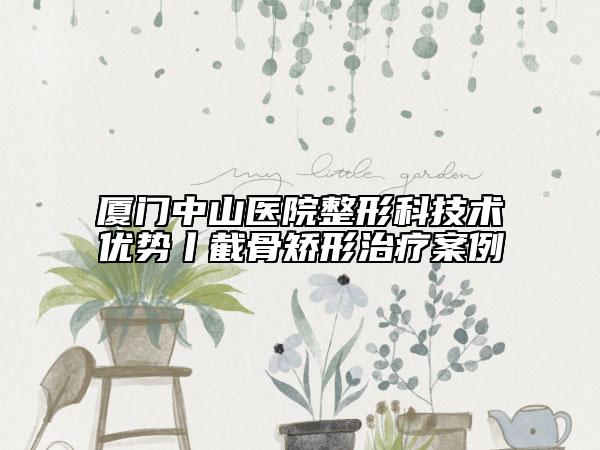 厦门中山医院整形科技术优势丨截骨矫形治疗案例