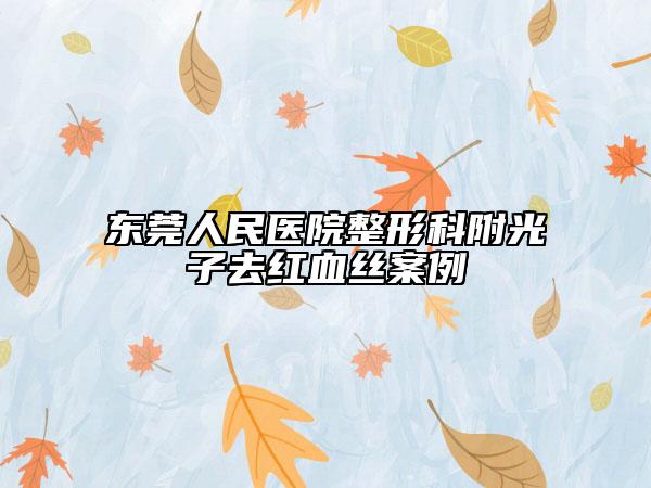 东莞人民医院整形科附光子去红血丝案例